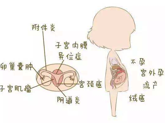 阴道分泌物香蕉视频黄污下载分析阴道炎早期症状