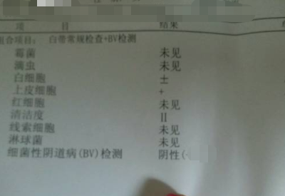 全自动白带在线观看香蕉视频分享如何看懂白带常规检测报告单